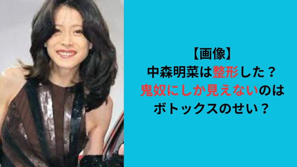 【画像】中森明菜は整形？鬼奴にしか見えないのはボトックスのせい？