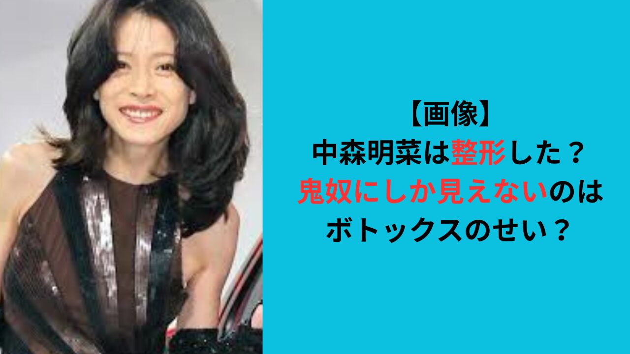 【画像】中森明菜は整形？鬼奴にしか見えないのはボトックスのせい？